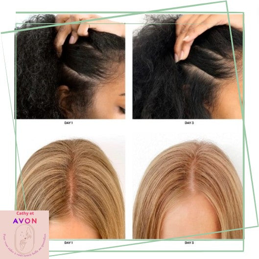 Avon AT Deeply Purifying- Cheveux Gras